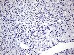 ZEB1 Antibody in Immunohistochemistry (Paraffin) (IHC (P))