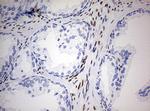 ZEB1 Antibody in Immunohistochemistry (Paraffin) (IHC (P))