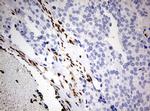 ZEB1 Antibody in Immunohistochemistry (Paraffin) (IHC (P))