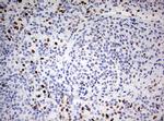 ZEB1 Antibody in Immunohistochemistry (Paraffin) (IHC (P))