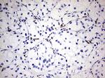 ZEB1 Antibody in Immunohistochemistry (Paraffin) (IHC (P))