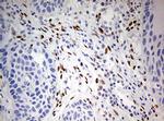 ZEB1 Antibody in Immunohistochemistry (Paraffin) (IHC (P))