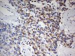 ZEB1 Antibody in Immunohistochemistry (Paraffin) (IHC (P))