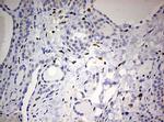 ZEB1 Antibody in Immunohistochemistry (Paraffin) (IHC (P))