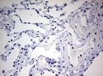 ZEB1 Antibody in Immunohistochemistry (Paraffin) (IHC (P))