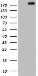 ZEB1 Antibody in Western Blot (WB)