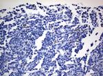 ZEB2 Antibody in Immunohistochemistry (Paraffin) (IHC (P))