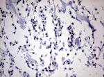 ZEB2 Antibody in Immunohistochemistry (Paraffin) (IHC (P))