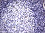 ZEB2 Antibody in Immunohistochemistry (Paraffin) (IHC (P))