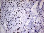 ZEB2 Antibody in Immunohistochemistry (Paraffin) (IHC (P))