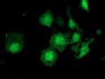 ZFAND2B Antibody in Immunocytochemistry (ICC/IF)