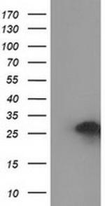 ZFAND2B Antibody in Western Blot (WB)