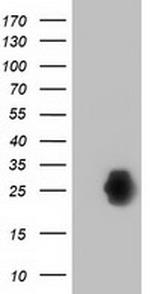 ZFAND2B Antibody in Western Blot (WB)