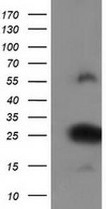 ZFAND2B Antibody in Western Blot (WB)