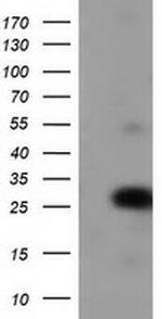 ZFAND2B Antibody in Western Blot (WB)