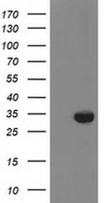 ZFAND2B Antibody in Western Blot (WB)