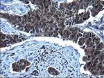 ZFAND3 Antibody in Immunohistochemistry (Paraffin) (IHC (P))