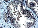 ZFAND3 Antibody in Immunohistochemistry (Paraffin) (IHC (P))