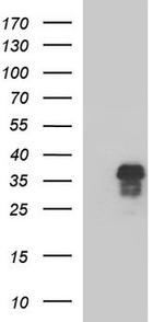 ZFAND3 Antibody in Western Blot (WB)