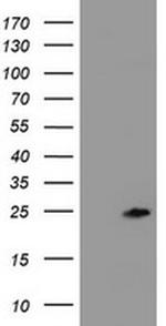 ZFAND5 Antibody in Western Blot (WB)