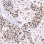 ZFP106 Antibody in Immunohistochemistry (IHC)