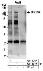 ZFP106 Antibody in Immunoprecipitation (IP)