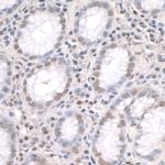 ZFP106 Antibody in Immunohistochemistry (IHC)