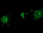 ZFP36 Antibody in Immunocytochemistry (ICC/IF)