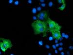 ZFP36 Antibody in Immunocytochemistry (ICC/IF)