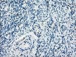 ZFP36 Antibody in Immunohistochemistry (Paraffin) (IHC (P))