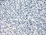 ZFP36 Antibody in Immunohistochemistry (Paraffin) (IHC (P))