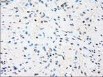 ZFP36 Antibody in Immunohistochemistry (Paraffin) (IHC (P))