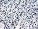 ZFP36 Antibody in Immunohistochemistry (Paraffin) (IHC (P))