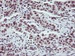 ZFP36 Antibody in Immunohistochemistry (Paraffin) (IHC (P))