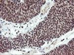 ZFP36 Antibody in Immunohistochemistry (Paraffin) (IHC (P))