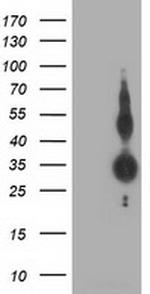 ZFP36 Antibody in Western Blot (WB)