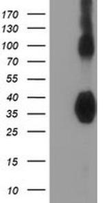 ZFP36 Antibody in Western Blot (WB)