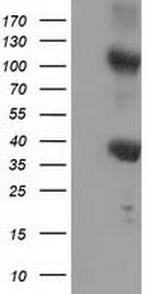 ZFP36 Antibody in Western Blot (WB)