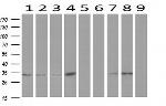 ZFP36 Antibody in Western Blot (WB)