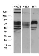 ZFP37 Antibody in Western Blot (WB)