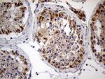 ZFP57 Antibody in Immunohistochemistry (Paraffin) (IHC (P))