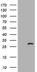 ZFYVE21 Antibody in Western Blot (WB)