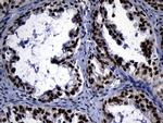 ZHX2 Antibody in Immunohistochemistry (Paraffin) (IHC (P))