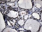 ZHX2 Antibody in Immunohistochemistry (Paraffin) (IHC (P))