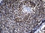 ZHX2 Antibody in Immunohistochemistry (Paraffin) (IHC (P))