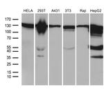 ZHX2 Antibody in Western Blot (WB)