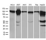 ZHX2 Antibody in Western Blot (WB)