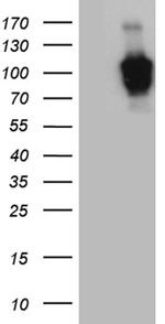 ZHX2 Antibody in Western Blot (WB)