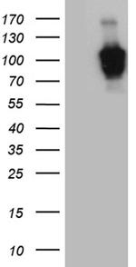 ZHX2 Antibody in Western Blot (WB)