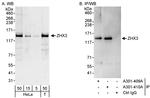 ZHX3 Antibody in Western Blot (WB)